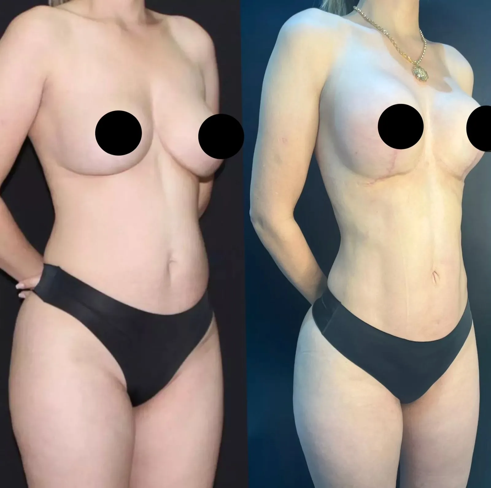 Antes e depois — resultado real