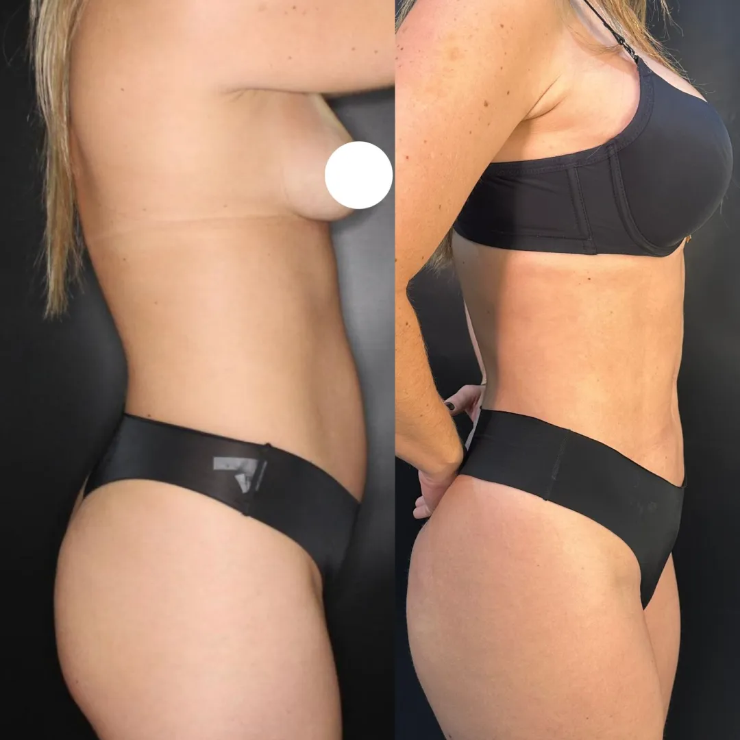 Antes e depois — resultado real