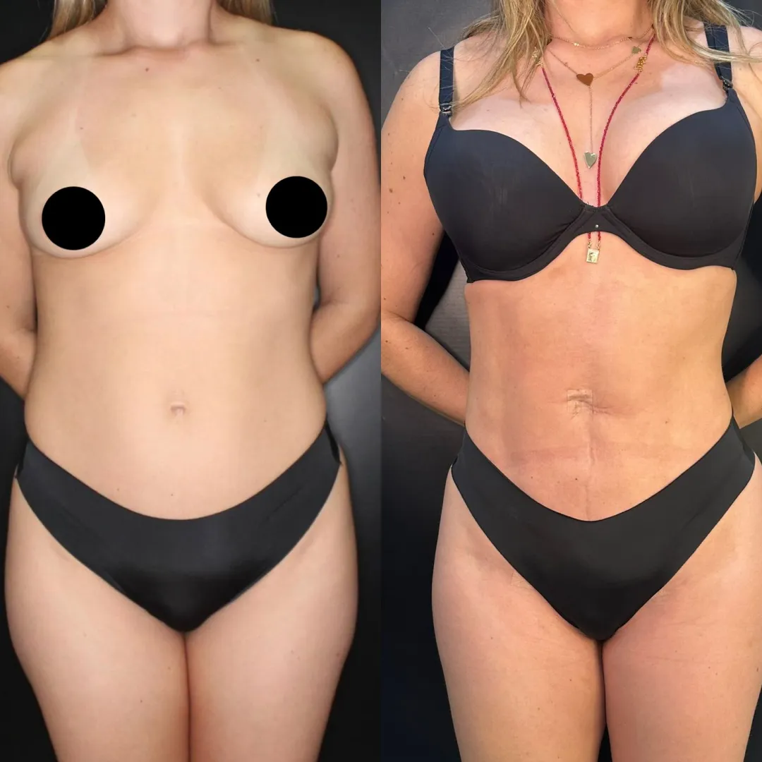Antes e depois — resultado real
